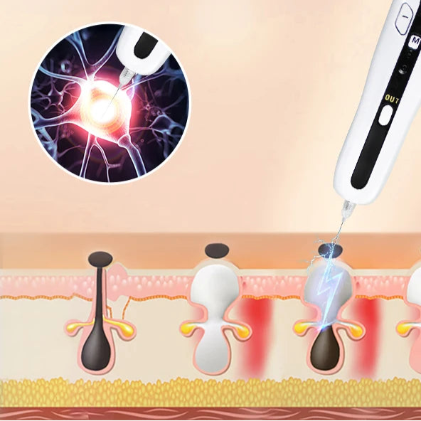 Precision Meets Renewal – 2-in-1 Ozone Plasma Pen for Skin Lifting, Spot Removal & Gentle Confidence